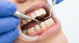 Was Tun bei Aphten: Ursachen, Sofortmassnahmen und Tipps - Arando Gesundheitsmagazin