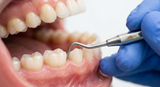 Aphten auf der Zunge: Ursachen, Symptome und was hilft - Arando Gesundheitsmagazin