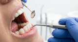 Aphten Behandlung Apotheke: Welche Mittel gibt es und was wirkt? - Arando Gesundheitsmagazin